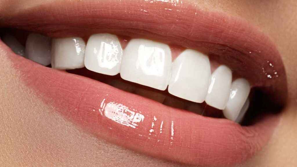 Qual é o melhor clareador dental do Brasil